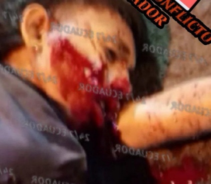 Young man executed by sicario in Guayaquil Ecuador 