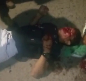 Two injured after collision between two speeding Motorcycle 