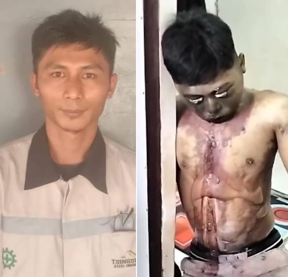 Hanging, Bloated & Decomposing