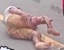 Two citizens were left with SERIOUS INJURIES to THEIR LEGS