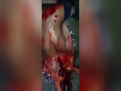 Man with a deep cut on the floor