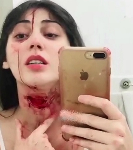 Self Harm Gone Bad, very bad 