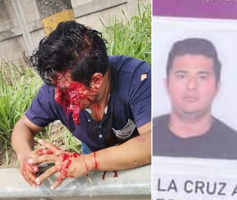 Seems The Helmet Didn't Help...