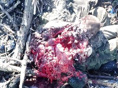 THIS WEEK'S GORIEST CASULTY (FULL + HD)