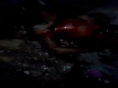 Man in Agony With Injuries All Over the Body Taken to Hospital on a Bike!