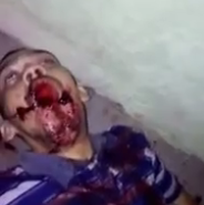 Bandit in Agony After Getting Shot to the Face 7 Times