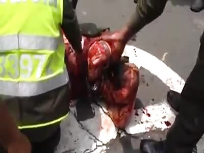 Man Stabbed 5 Times by His Colleagues Taken to Hospital by Police