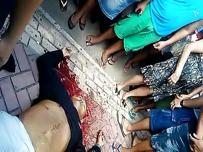 Man with Weird Looking Face Lying Dead in the Street after Getting Shot