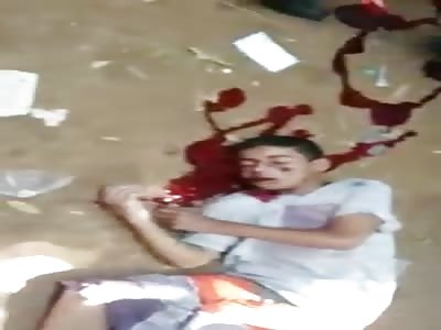 Dying Young Boy Gasping for Air after Getting Shot