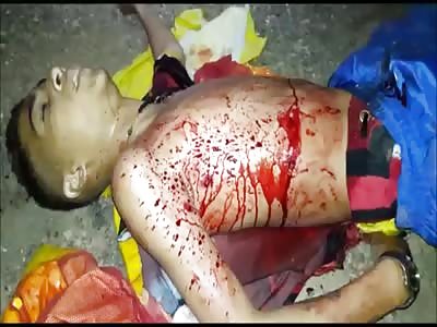 Blood Oooozing Out of Gun Shot Wound after Thug Got Shot by Police