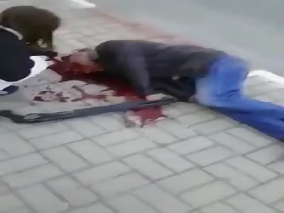 Shotgun Blast to the Head (Aftermath)