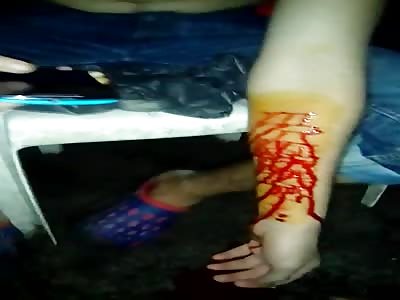 Self-Injury Disorder!