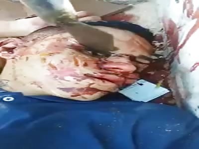 Man Found Dead with a Knife in the Eye