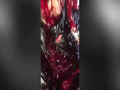 Murder Attempt and Bloody Aftermath