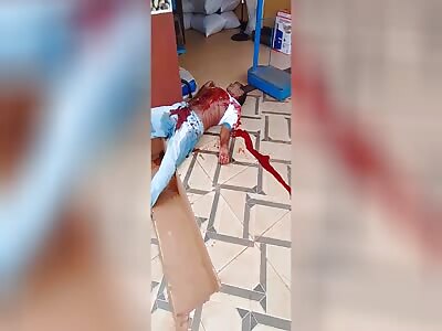 Victim of stabbing in fight