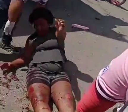 Couple on motorcycle crashed by speeding car 