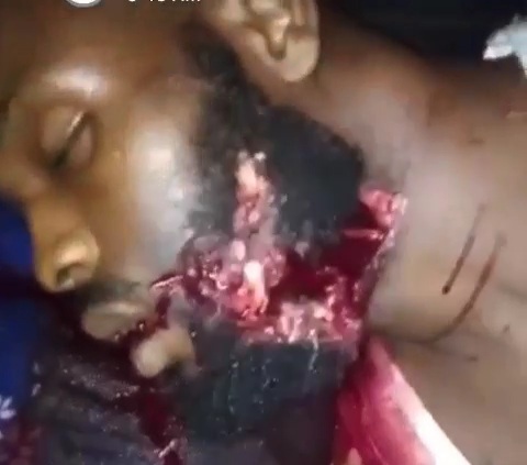 Another victim of the BLACK AXE GANG MEMBERS gets his FACE-OFF 