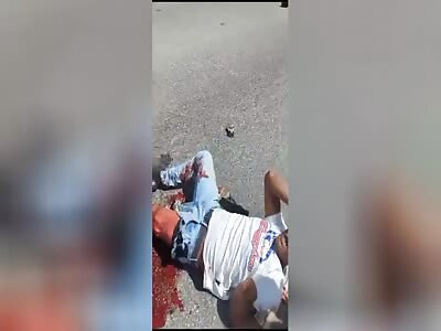 BRUTAL INJURIES IN TRAFFIC ACCIDENT DOMINICAN REPUBLIC 