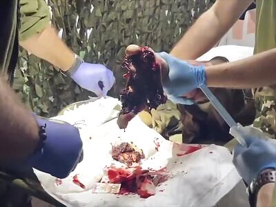 Gore Mania—Russian Field Surgeon Solves Meat Puzzles