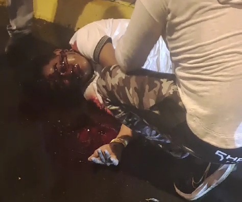 LAS GASPS OF AIR AFTER GETTING A HEADSHOT BY SICARIO 