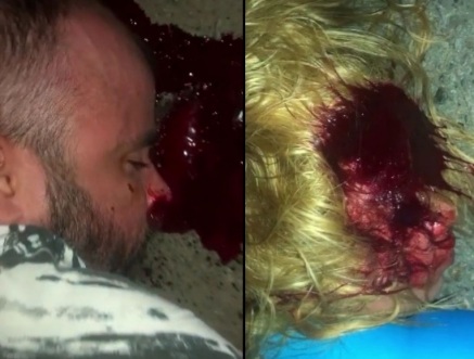 Collision between two speeding motorcycle leave couple dead 