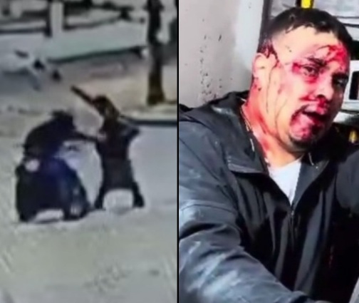 [ACTION AND AFTERMATH]Thief punished hard for stealing from lady 