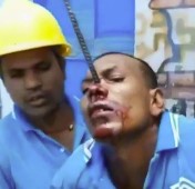 worker had a serious accident with rebar