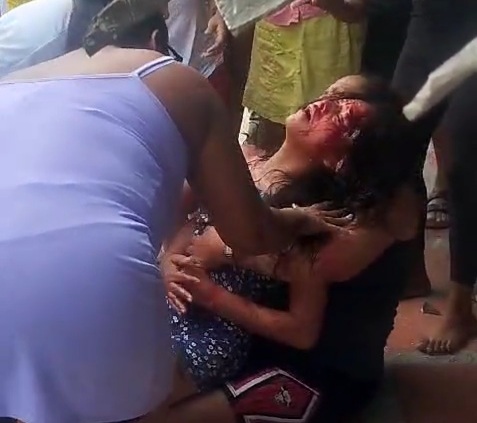 Motorcycle accident leaves three people seriously injured