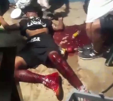 Two young victims after sicario open fire in local bar 