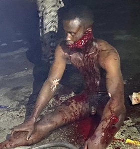 Cable Thief...Can't Outrun the Bloody Mob Beating.