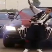 Algerian man accidentally blew off his foot at a wedding