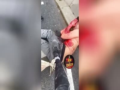 Dude Taking A Bite Of His Arm