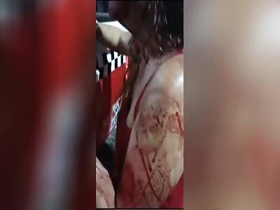 Woman beaten by husband