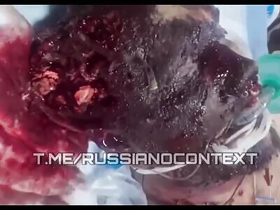 Ukraine Death Comp LXVII