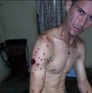 Venezuelan gets shot by police during protest 