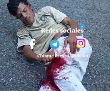  Horrific aftermath of motorcyclist crashed by truck 