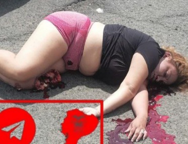 serious traffic accident leaves a woman lying WITHOUT VITAL SIGNS 