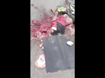 Cyclist Got Splattered