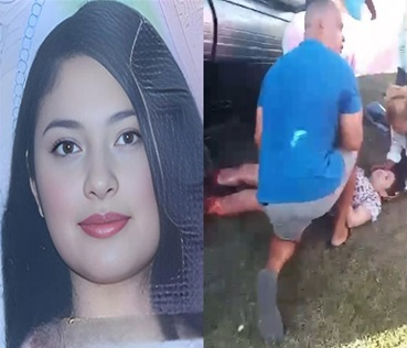 Woman in Shock Has Legs Shredded Like Pulled Pork