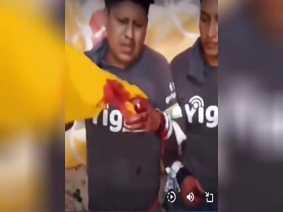 Kidnapped Worker Shows Us His Cut-Off Middle Finger