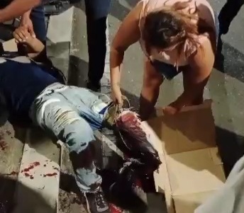 Horrible leg injury after motorcycle accident 