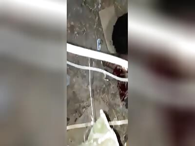 His Eye Is Popping Out