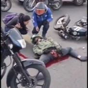 Biker Shows Woman His Ripped Genitals