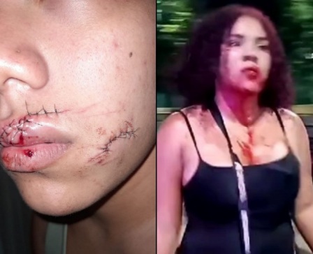 Loud Mouth Girl Stabbed in the Face with a Broken Bottle 