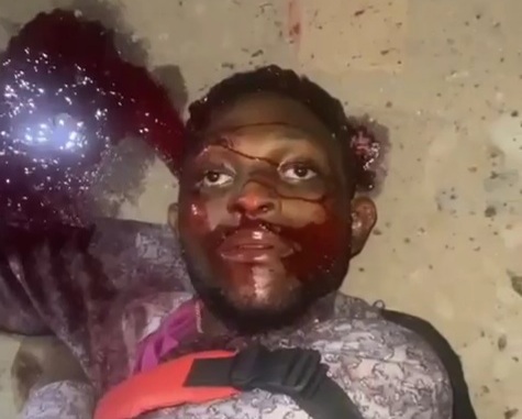 Rival butchered by the BLACK AXE GANG 