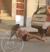 Woman Stabbed in Fight