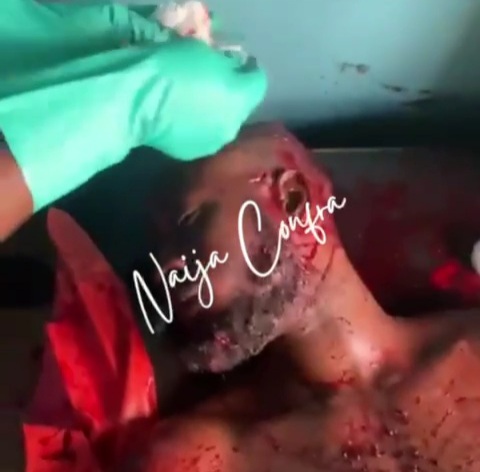 Viking member hospitalized after being butchered by the BLACK AXE GANG