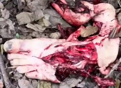 Russian soldier stepped on a petal mine and lost his foot