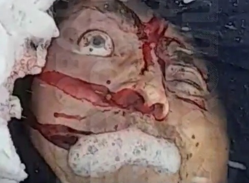 Bus Driver Fell Asleep.