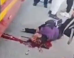 [CRACKED SKULL] Pedestrian Head Crashed by Bus 